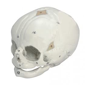 fetal skull model delux